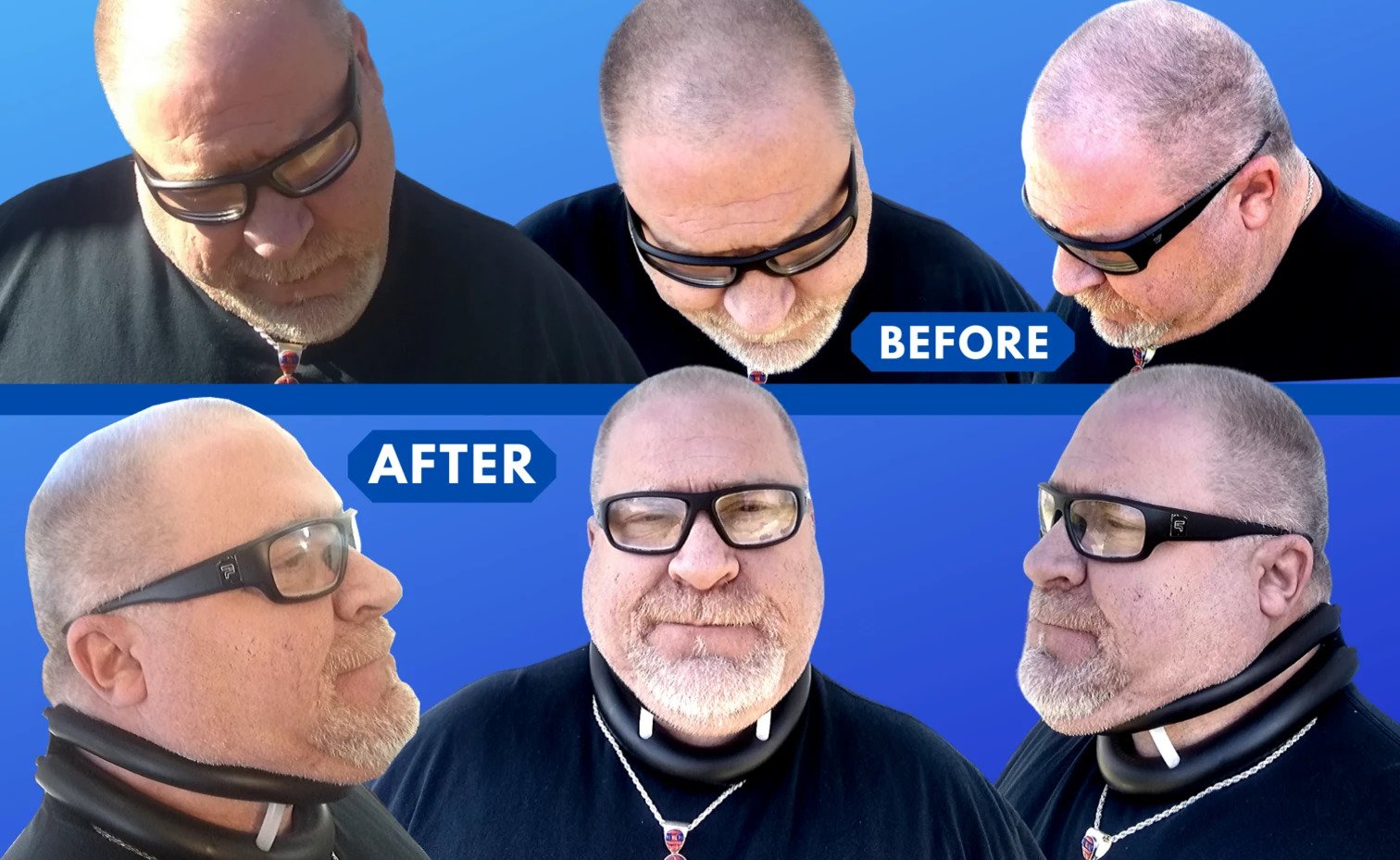 Home Optimal Neck Support Brace